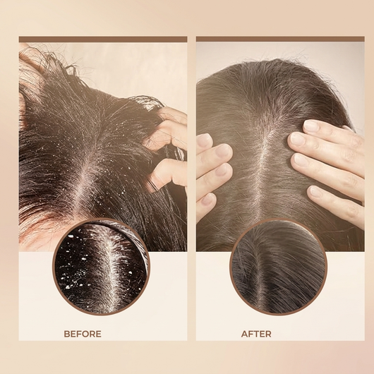 Scalp Exfoliating Scrub